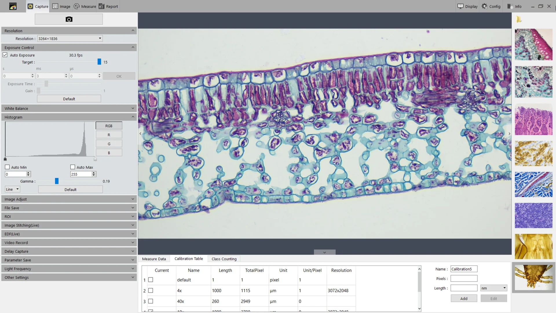 EXCELIS™ HD - Image 4